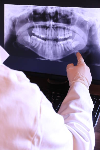 Best Same-Day Emergency Dentist in New City, NY